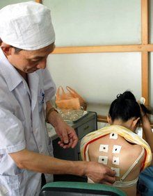 （图）冬病夏治